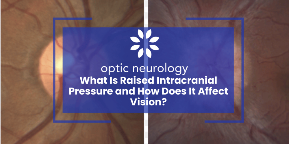 Raised Intracranial Pressure