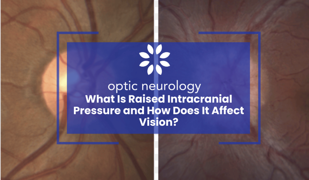Raised Intracranial Pressure