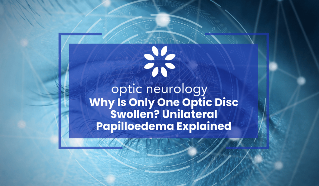Unilateral Papilloedema